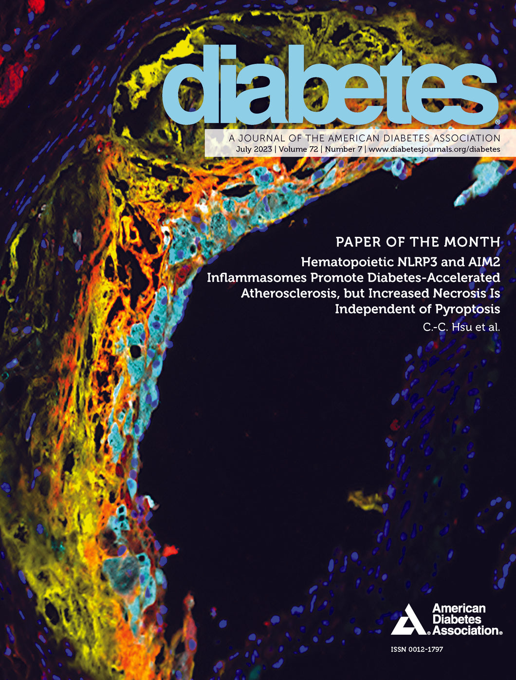 Diabetes Journal, Volume 72, Issue 7, July 2023
