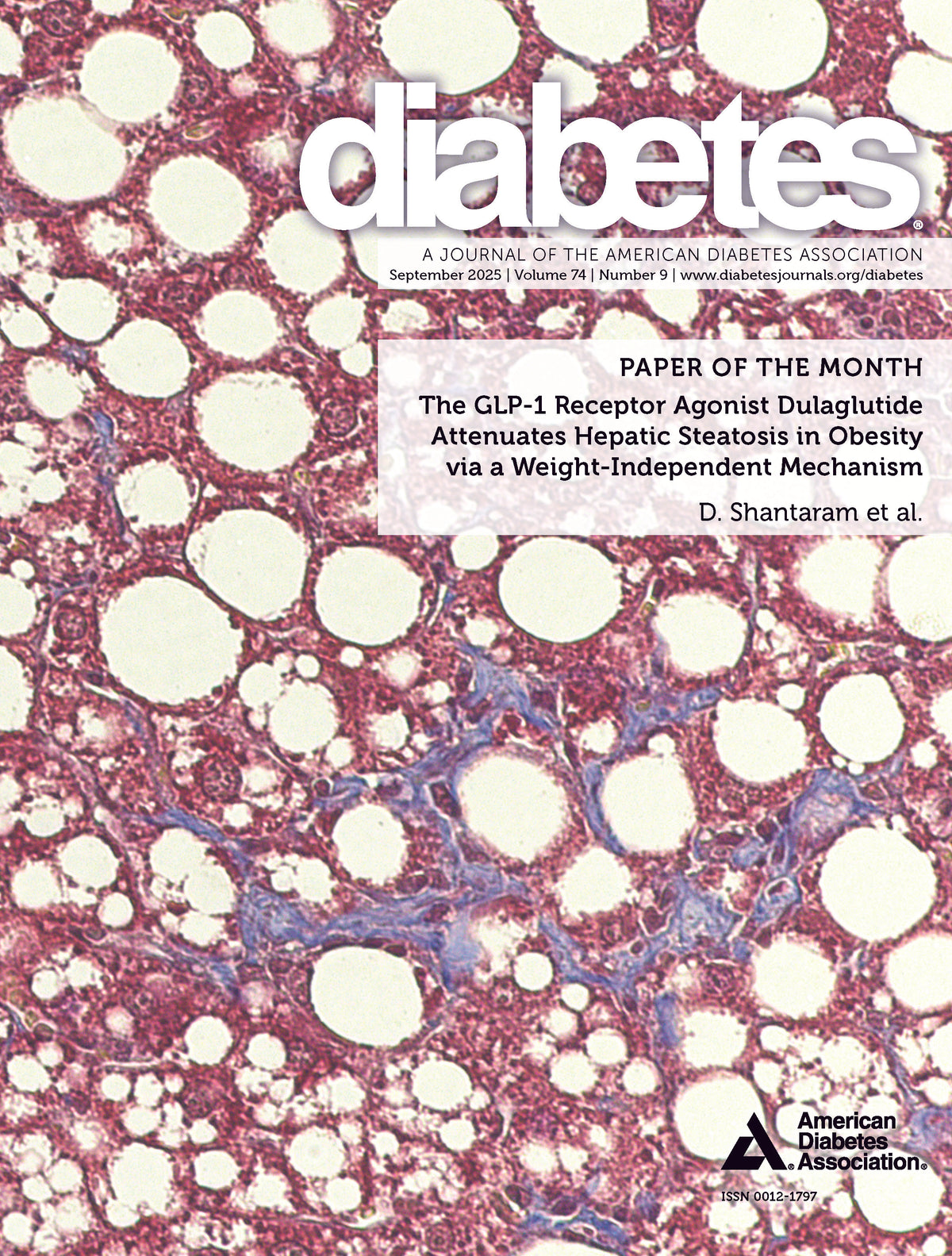 Diabetes Journal, Volume 74, Issue 9, September 2025