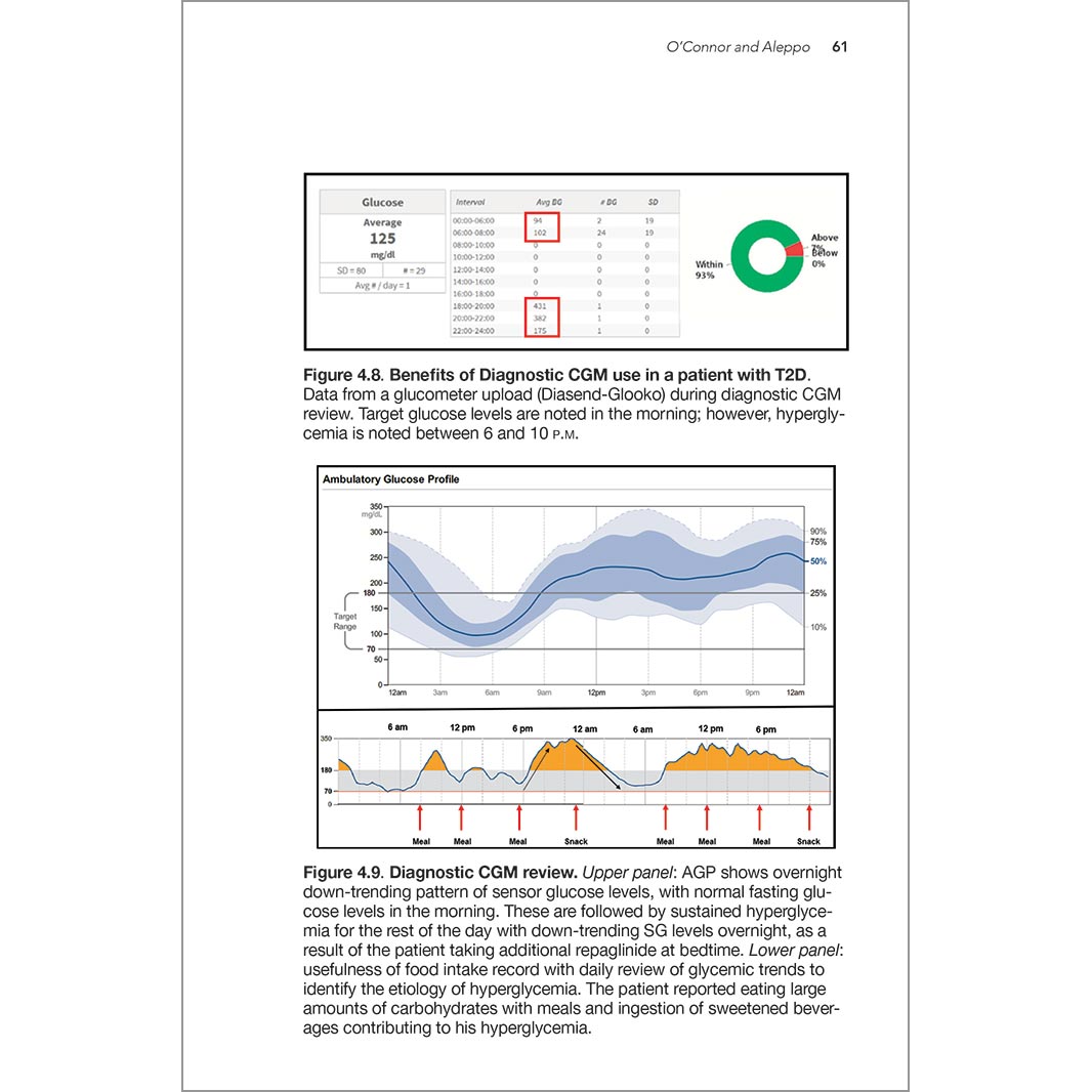 Diabetes Technology: Science and Practice