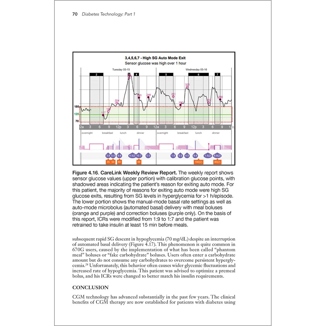 Diabetes Technology: Science and Practice